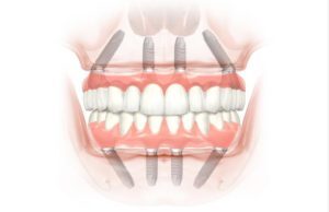 Vista general 1 300x194